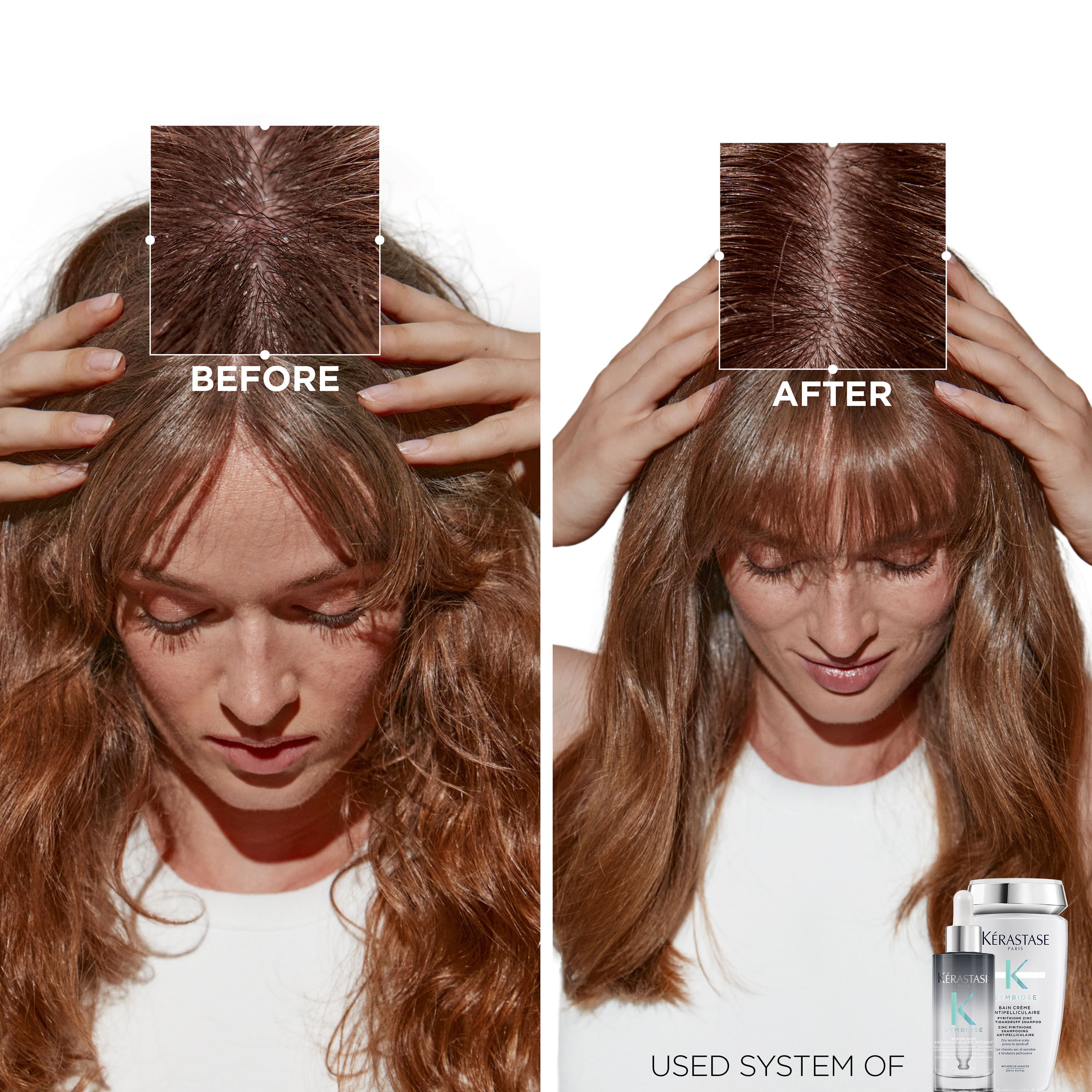 Anti Dandruff Shampoo – 6 Elements Hair Spa