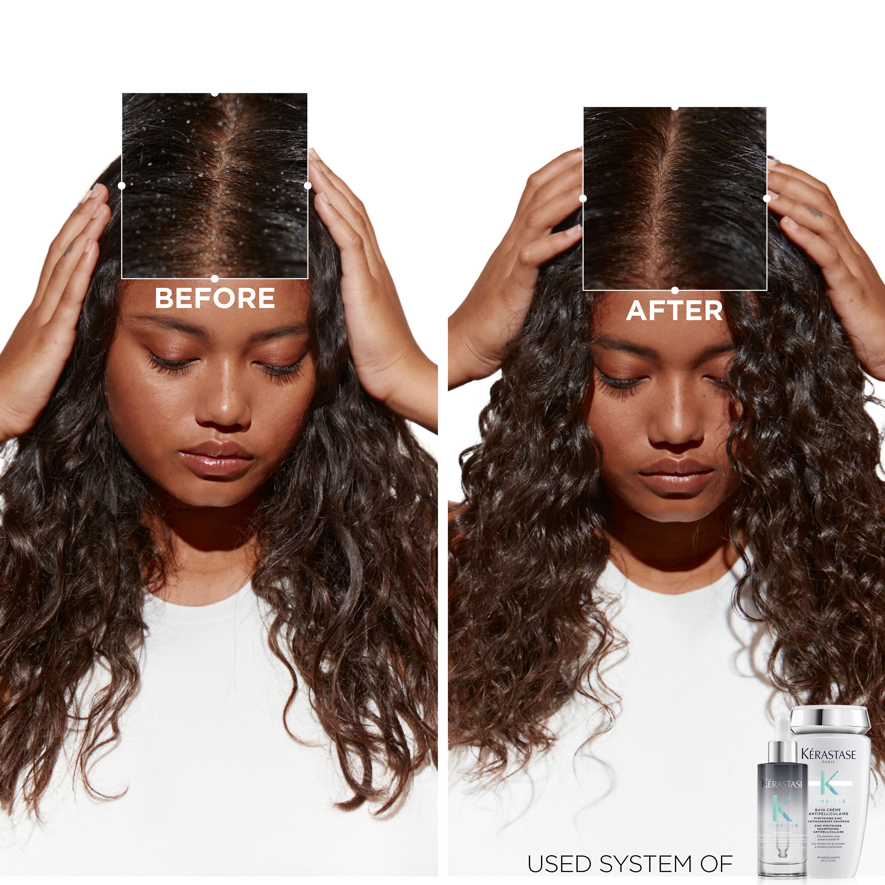Advantages and Disadvantages of Hair Spa – Re'equil